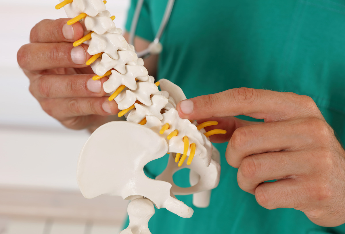 What to Know About a Herniated Disc